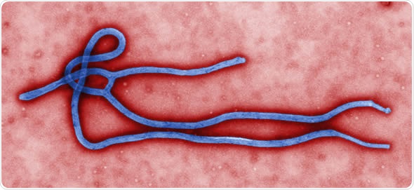 Ebola wirusa virion. Tworzy CDC mikrobiologa Cynthia złotnikiem, ten colorized przekazu elektronu micrograph wyjawiał niektóre ultrastructural morfologia wystawiająca Ebola wirusa virion.