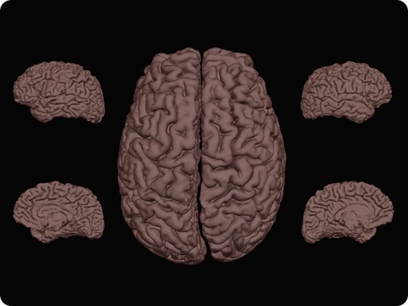 Fibro brain 1 - resized