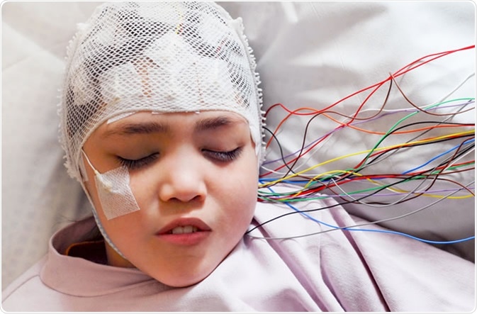 what is an eeg test used to diagnose