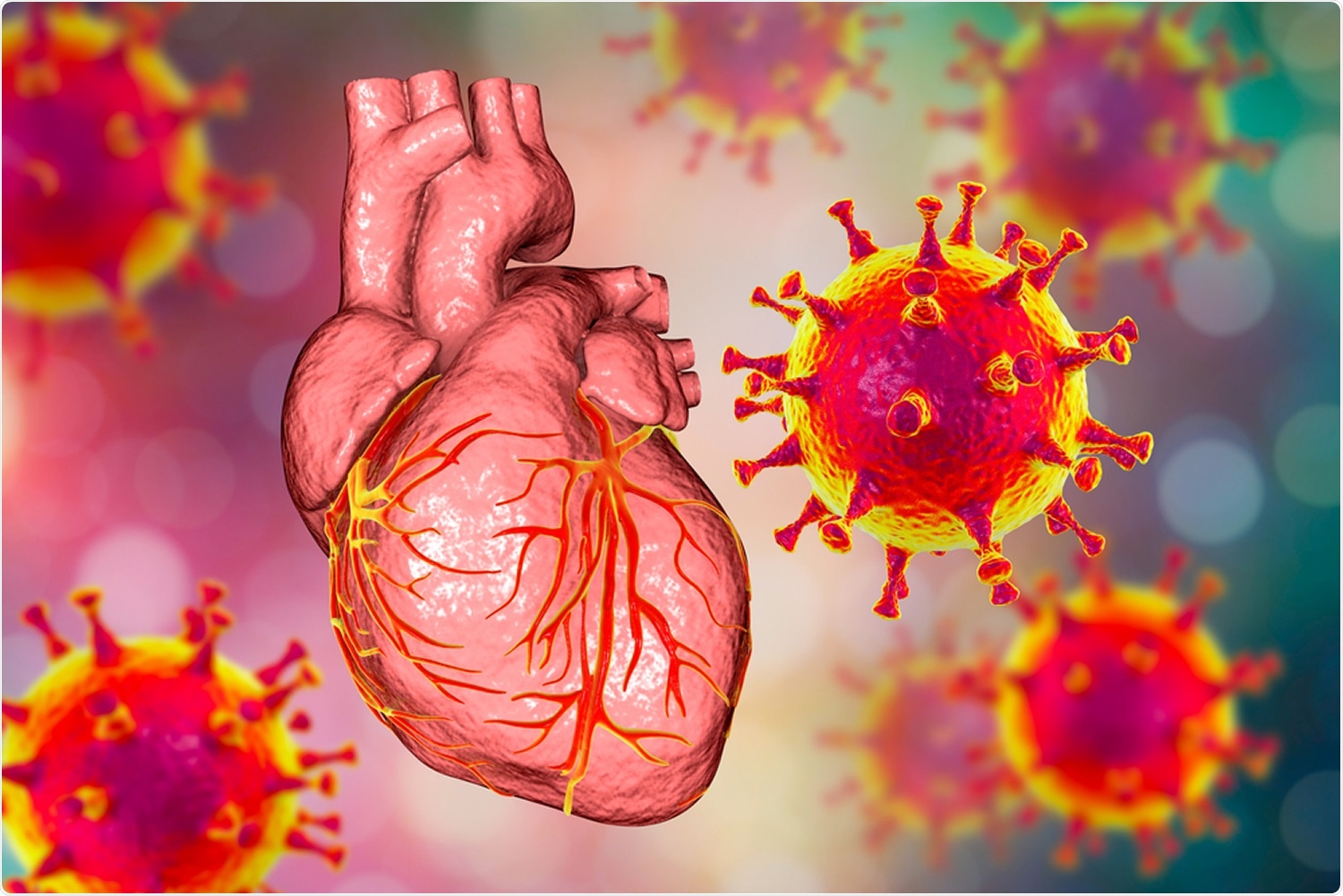 Covid 19 Myocardites Pericardites Chez Les Adolescents Vaccines Ce Que Disent Les Donnees Americaines