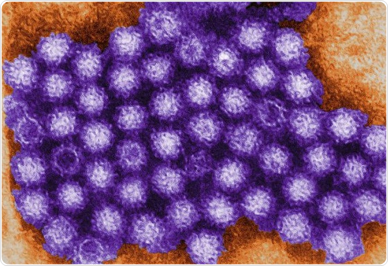 What Is Norovirus 9043