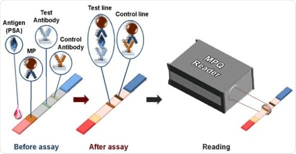 pregnancy test strip mechanism ì‹œìŠ¤í…œì€ ë‹¨ë°±ì§ˆ ì„¼ì„œ í˜ˆì•¡ì— ìƒˆë¡œìš´ ìžˆëŠ” ë°œì „í–ˆìŠµë‹ˆë‹¤ ë°”ì´ì˜¤ ì¸¡ì •ì„ ì‹œí—˜ ë¶„ìž ì •í™•í•œ ìœ„í•´ ë†ë„ì˜