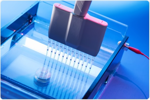 What Does Gel Electrophoresis Involve?