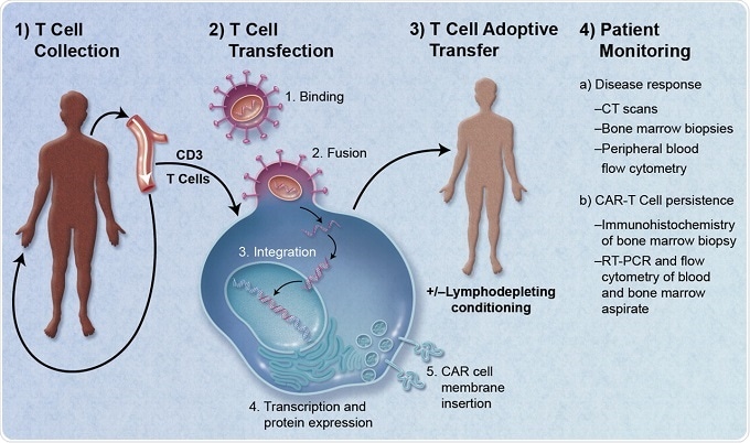 New immunotherapy sends multiple myeloma into remission