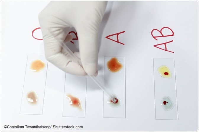 elimination-of-rhd-positive-rbc-concentration-mean-sd-following