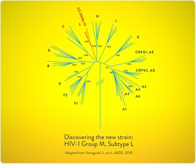 New Strain Of Hiv Discovered And Sequenced
