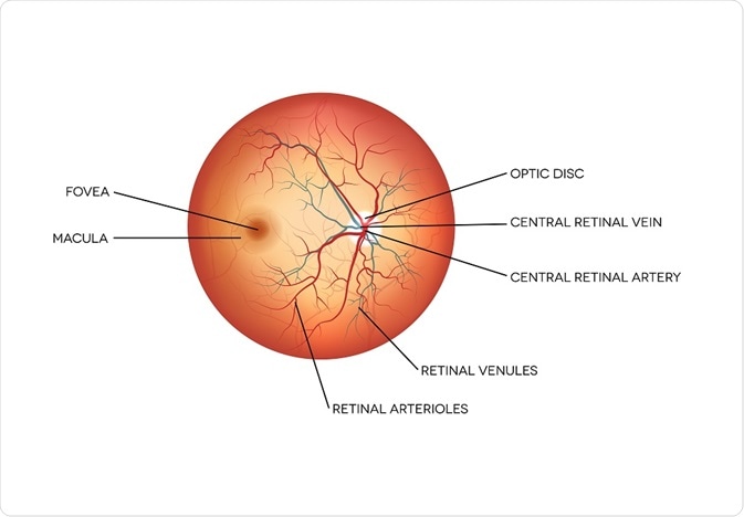 Swelling Of Optic Disc