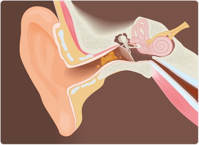 what-is-earwax