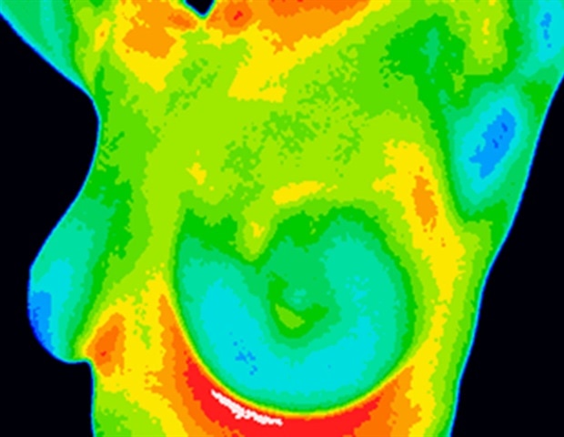 Thermography versus Mammography: Which is Best?