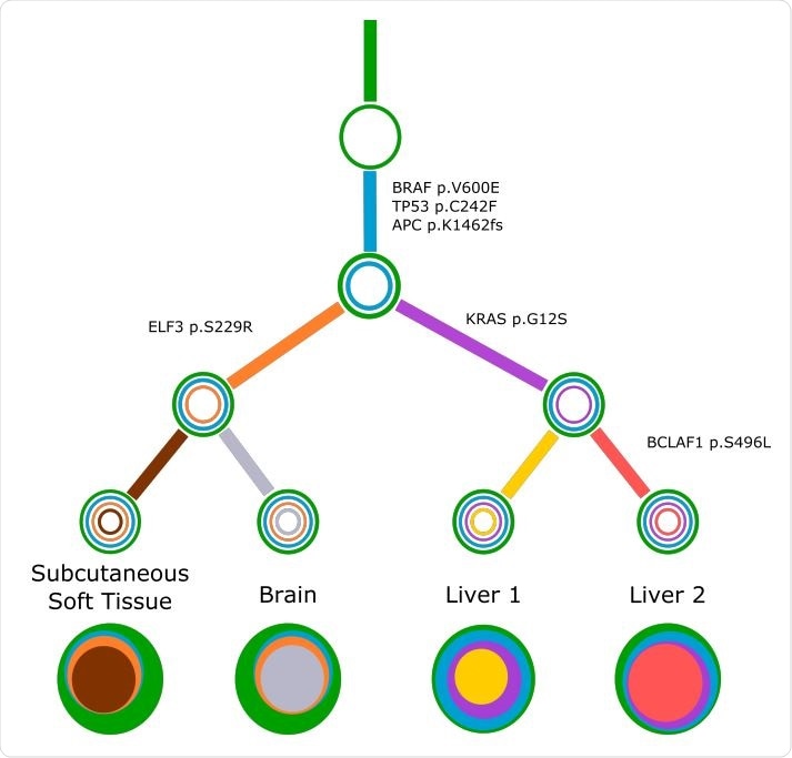 Concerti tumor evolution tree T for patient GI1. Tumor evolution tree T for colon cancer patient GI1 multi-site data. The edges of the T are labeled by the known cancer genes and the colors denote the distinct pseudoclones estimated by Concerti. Leaf nodes represent each of the distinct lesion sites. The single site trees T are shown at the bottom as stacked discs and the sizes are proportional to the prevalence values.