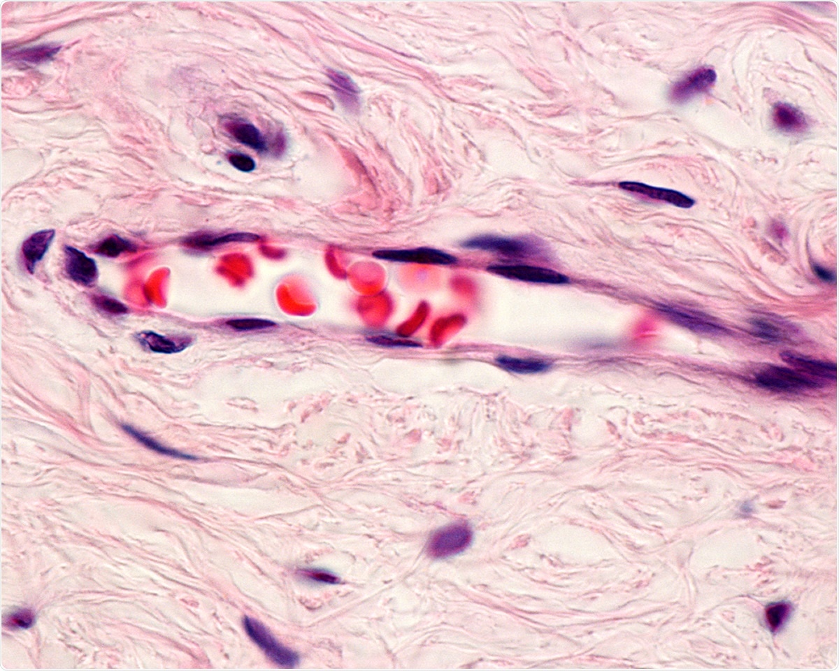 Endothelial cells resistant to SARS-CoV-2 infection