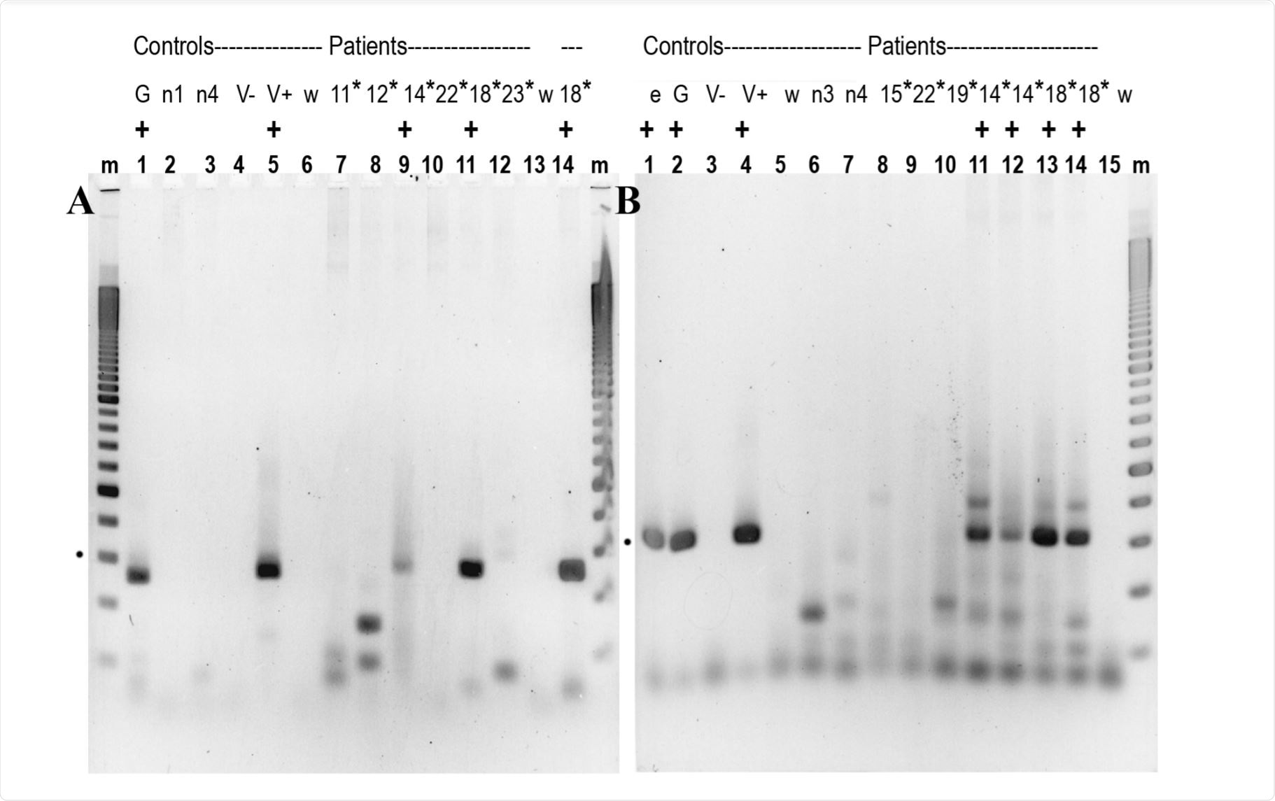 Detecting Sars Cov 2 Sequences In Blood Monocytes