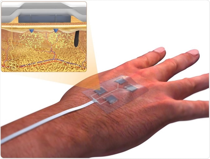 Les Scientifiques Developpent Le Pansement A Telecommande Intelligent Pour Les Blessures Continuelles