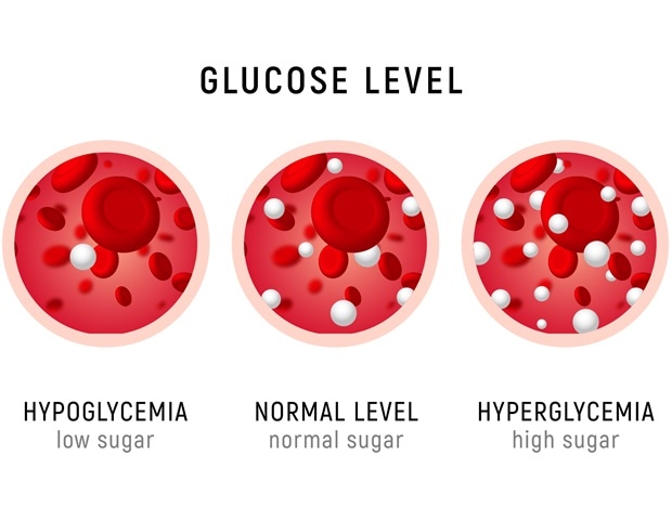 What is Hyperglycemia?