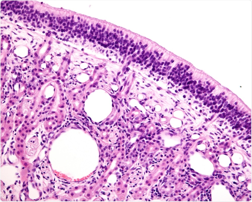 Loss of smell and taste as symptoms of COVID-19