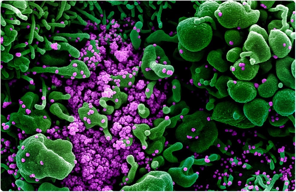 Inside The Cell The Biology Of The Novel Coronavirus Sars Cov 2 Scientist Blog