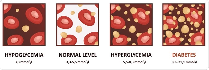 Glucose in the blood. Image Credit: logika600 / Shutterstock