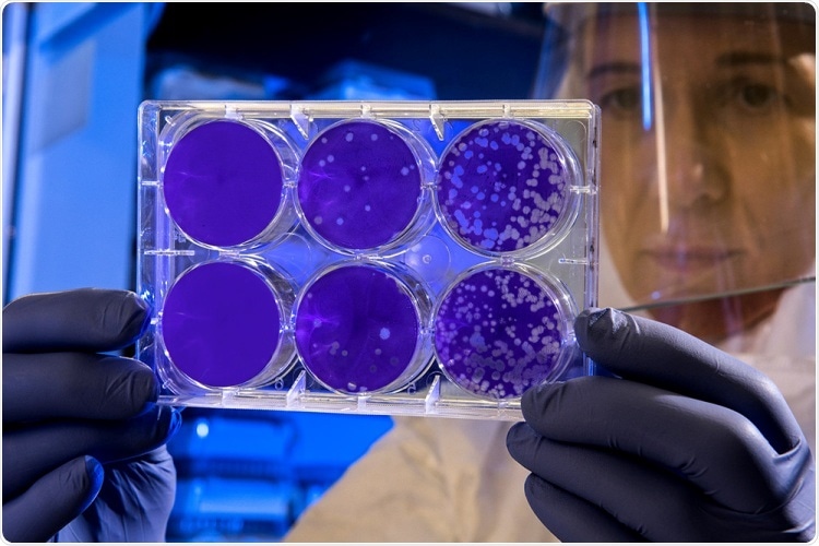 Rapid point-of-care testing using screen-printed electrodes from Metrohm DropSens