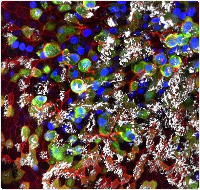 SARS-CoV-2 infected epithelial cells collected from healthy human bronchi. (Teresa Mascenik, the Randell Lab, UNC SOM)