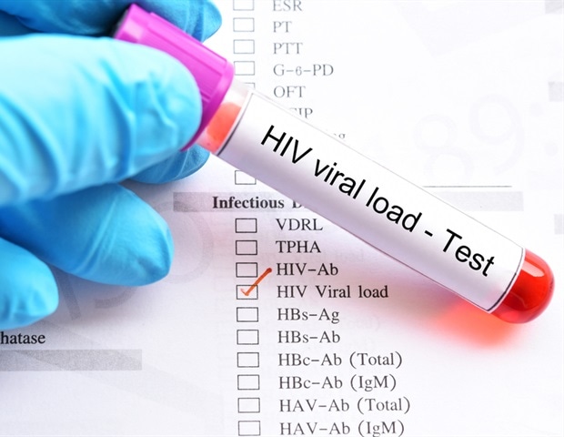 What is Viral Load?