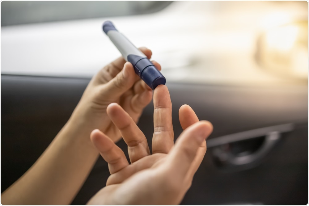 Study: Admission fasting blood glucose is an independent predictor of 28-day mortality in COVID-19 patients without previous diagnosis of diabetes: a multicenter retrospective study.  Image credit: Montri Thipsorn / Shutterstock