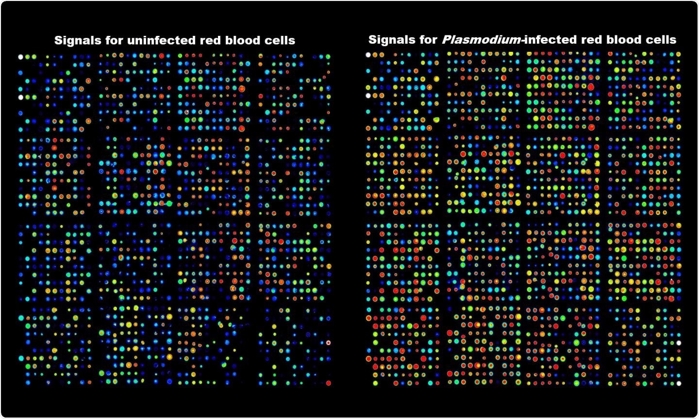 Antibody sequence data showing activation of kinases in human erythrocytes infected with malaria parasite.  Credit RMIT University
