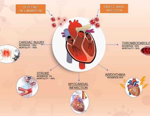 Cardiovascular Disease In Covid-19