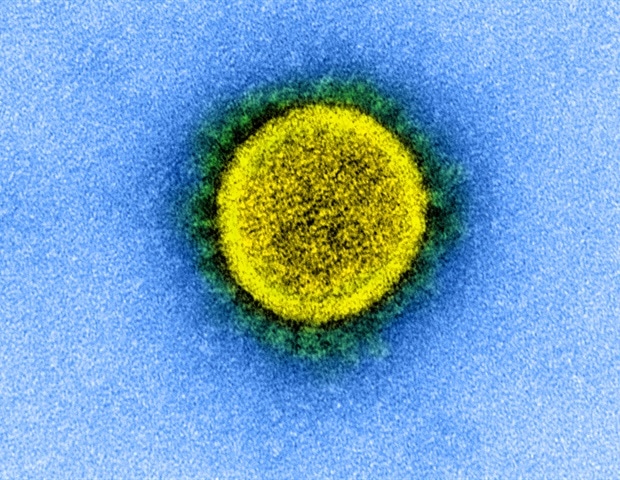 Relative Humidity Could Play A Role In Transmission Of Sars Cov 2 Indoors