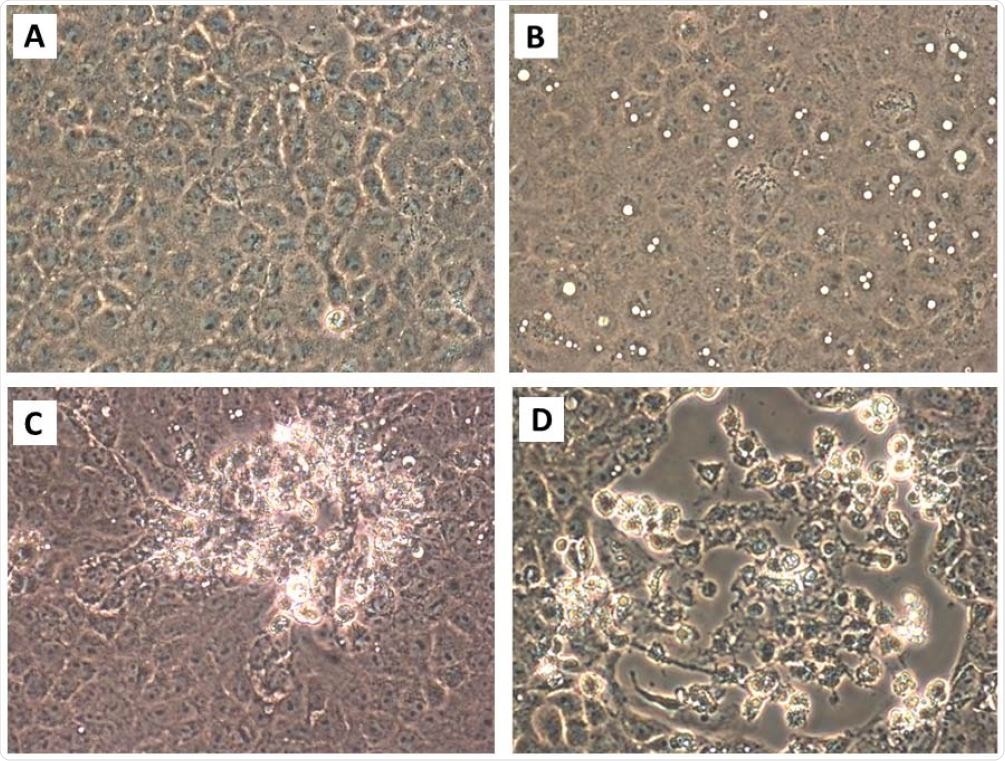 Cytopathic effect of Vero E6 cells inoculated with substances collected from air during air sampling 1-1. [A] Mock infected Vero E6 cells, 10 days post inoculation, sterile collection medium. [B]..  Large cytoplasmic vacuoles of Vero E6 cells inoculated at 4 dpi with collection medium from BioSpot Sample 1-1. [C] Early focus of infection 7 dpi. [D] The focus of infection is 10 dpi.  There are detached round cells, some of which are clumps.  Adherent cells that remain at the focus of this infection have a dark cytoplasm, some have large cytoplasmic inclusions, and some cells are elongated.  Original magnification at 400X.