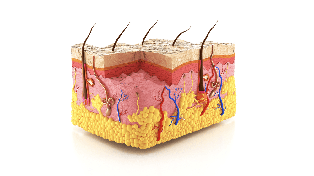 Dermatose Congenitale D Ichtyose De Harlequin