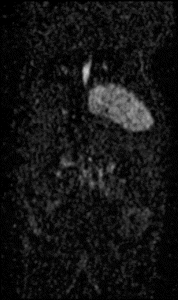 M-Series high-performance MRI