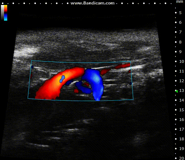 High-frequency ultrasound system for preclinical imaging