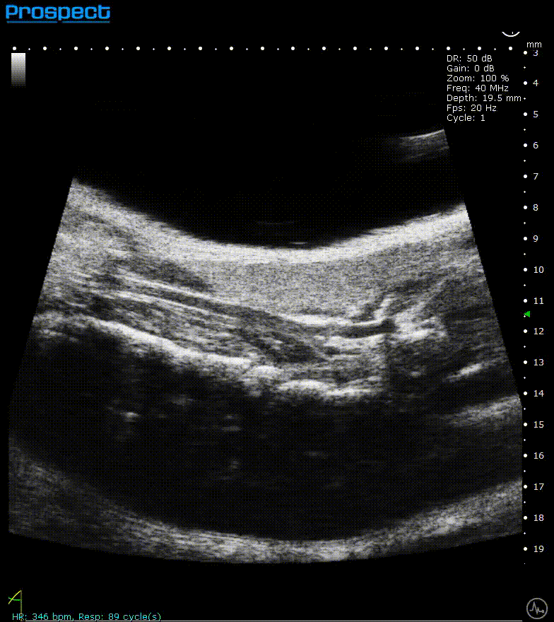 High-frequency ultrasound system for preclinical imaging