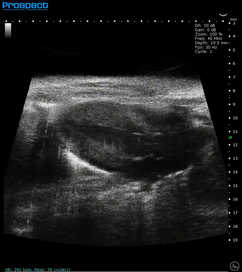 High-frequency ultrasound system for preclinical imaging