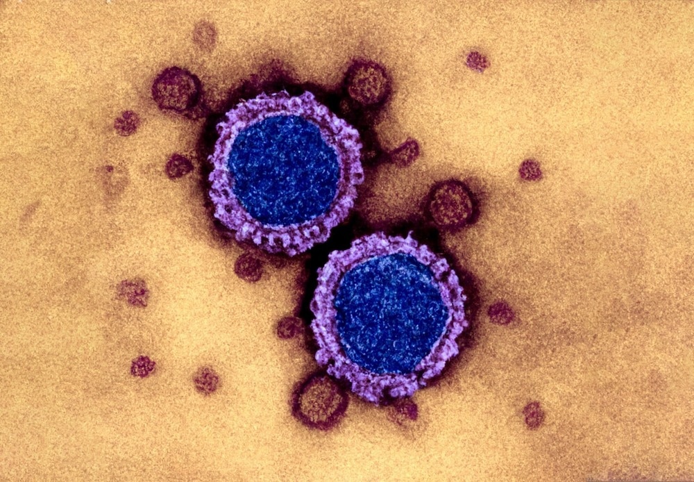 High-level resistance of SARS-CoV-2 BA.4 against neutralizing antibodies