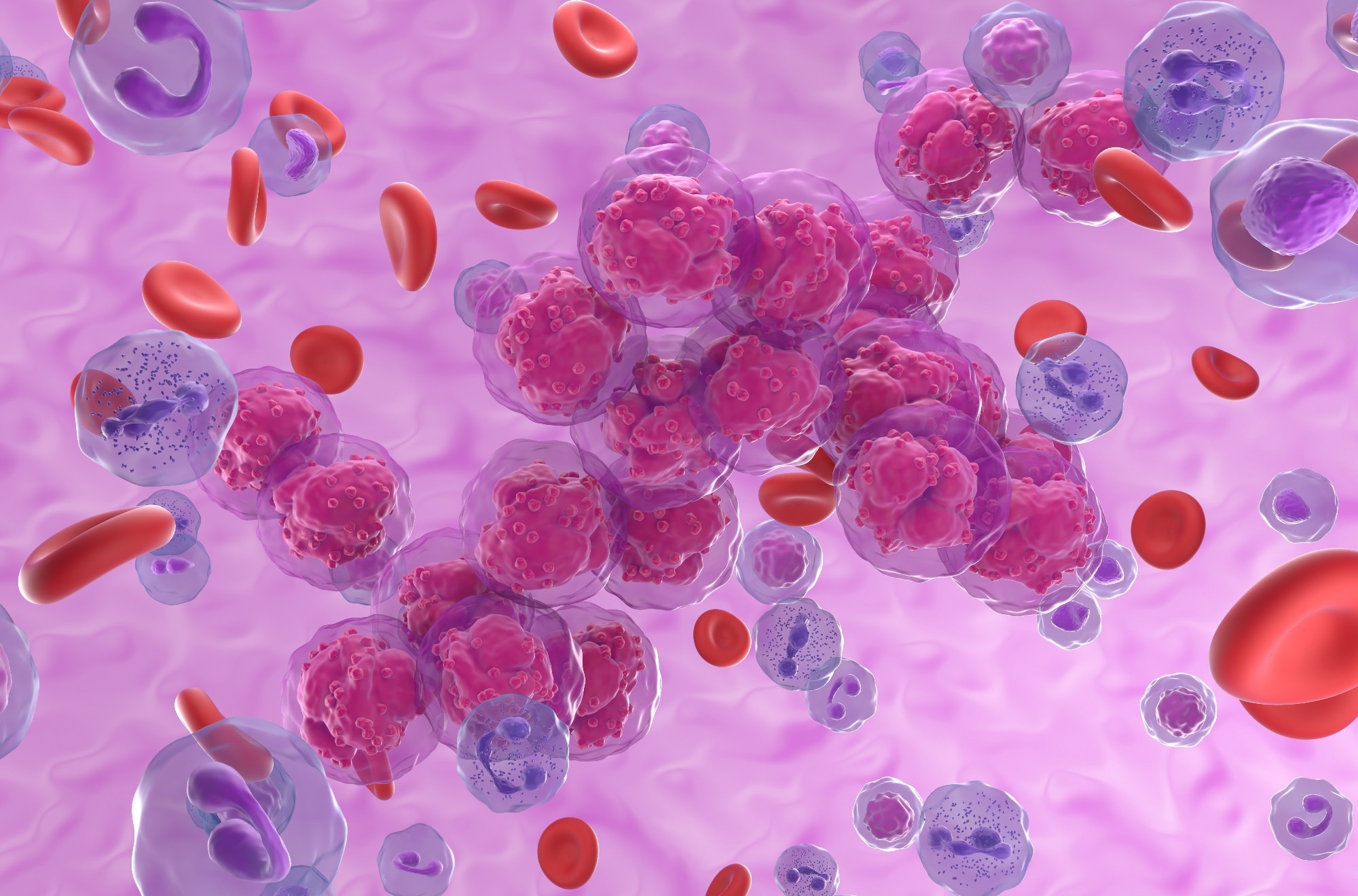 how quickly does leukemia develop